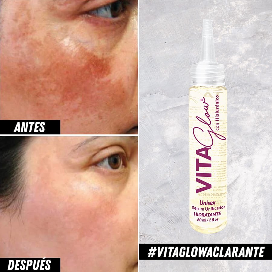 VITAGLOW ® SERUM ACLARANTE - Nova Oficial -